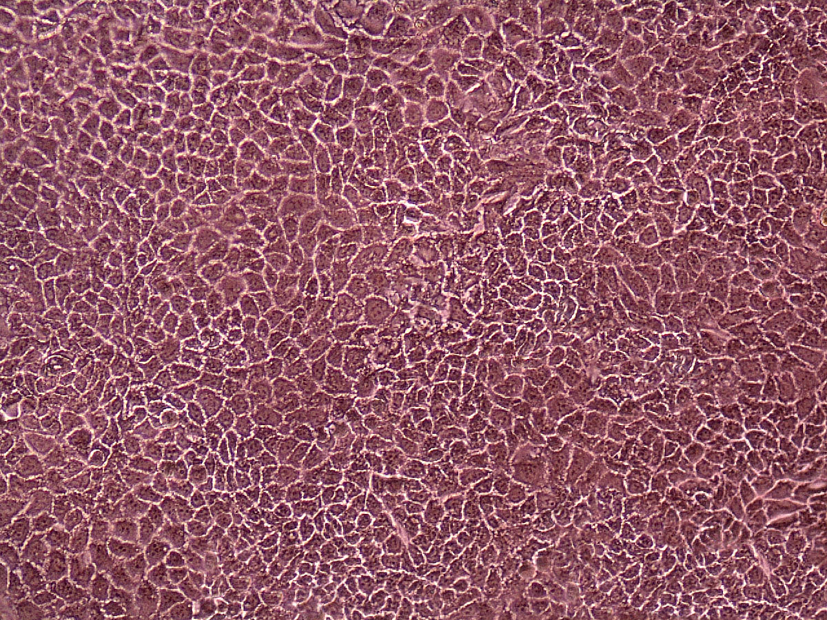 ReadyCell-DM-CacoReady-Image-Caco2