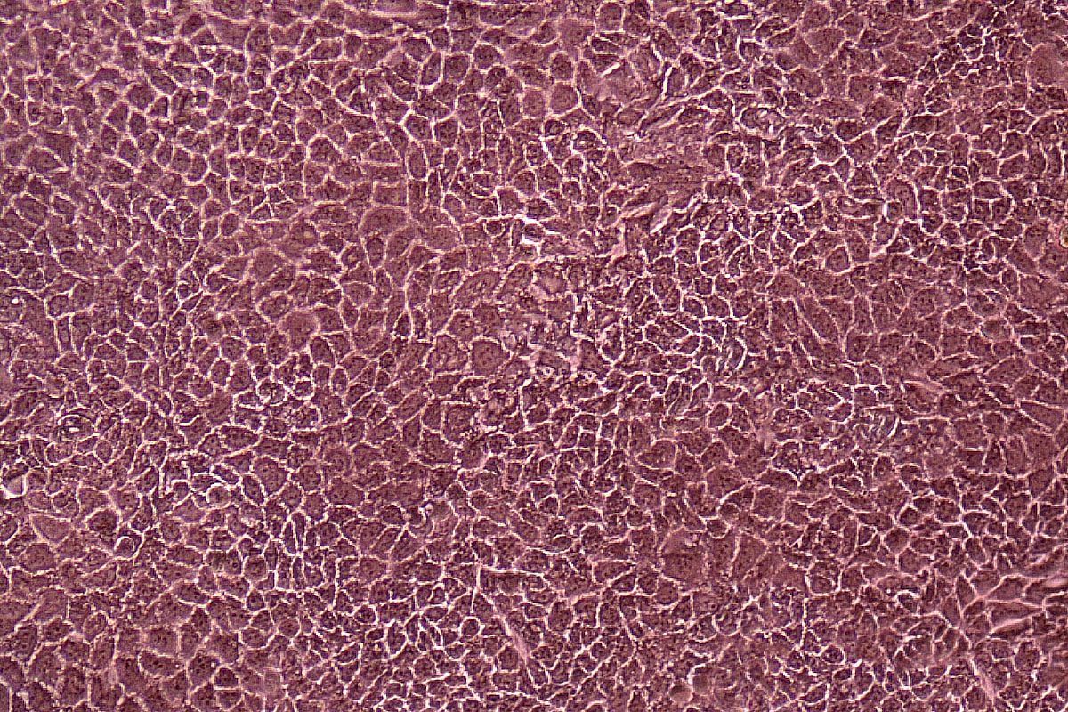 ReadyCell-DM-CacoReady-Image-Caco2