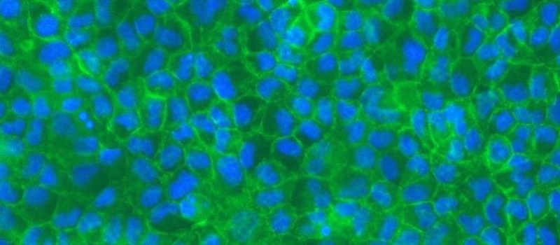 MDCKII Permeabilty Assay
